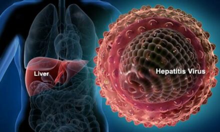 Belum Ditemukan Hepatitis Akut Pada Anak di Purbalingga
