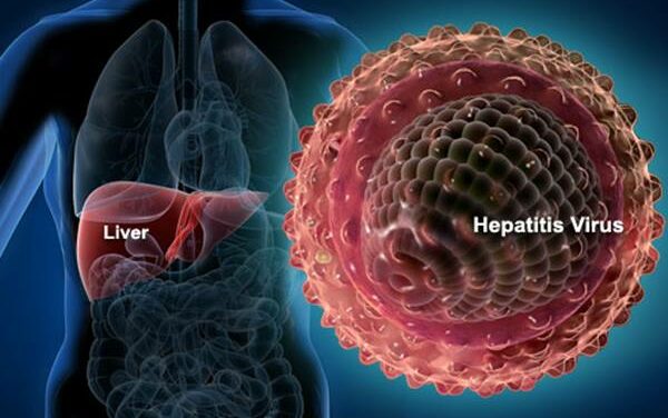 Belum Ditemukan Hepatitis Akut Pada Anak di Purbalingga